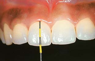 periodoncia